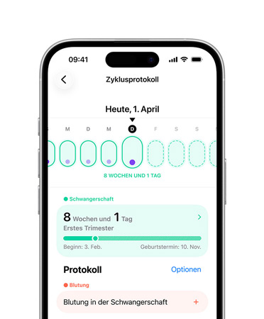 iPhone, Zyklusprotokoll in der Health App eingestellt, um Meilensteine der Schwangerschaft zu tracken