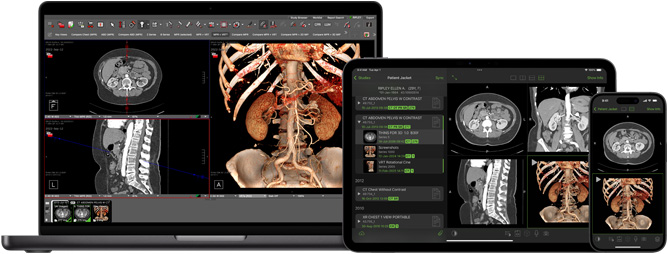 Interfaccia software dell’app Visage, che i team di radiologia usano per interpretare file diagnostici di grandi dimensioni.