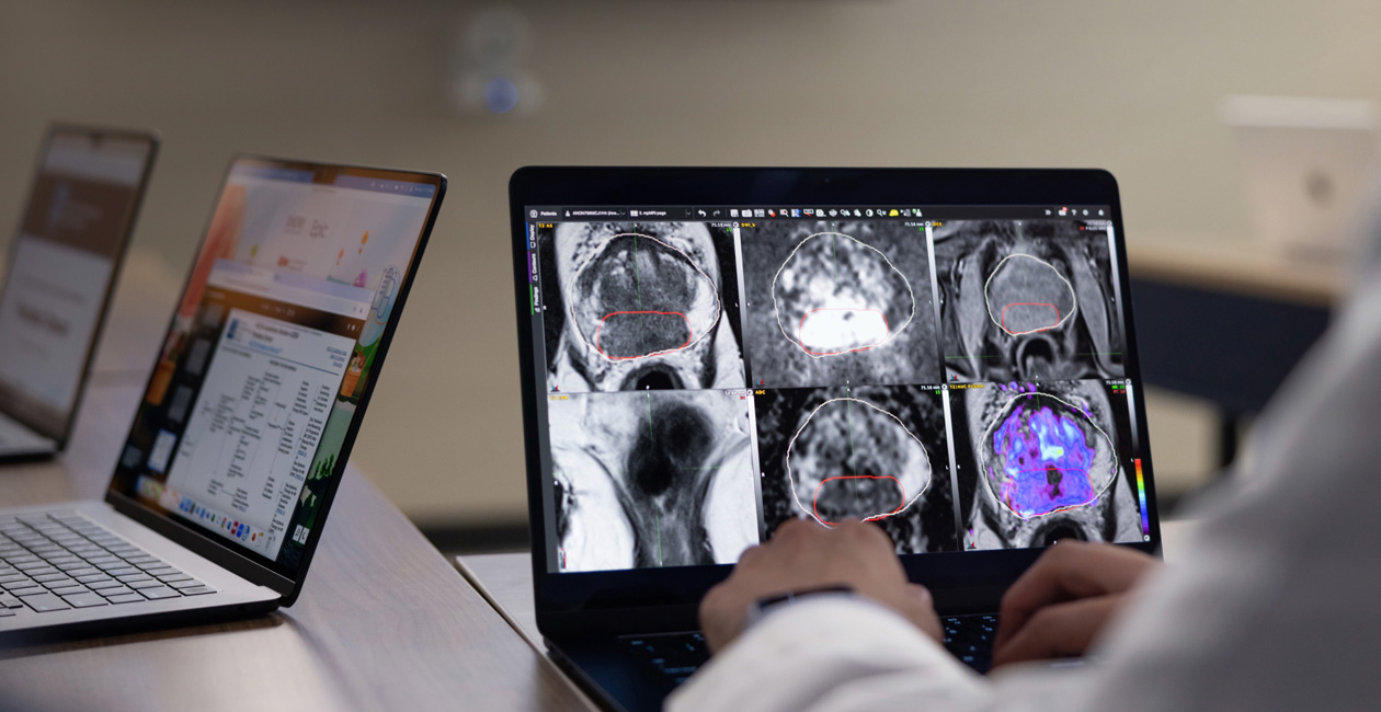 Een MacBook Pro met radiologiebeelden.